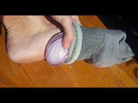 Onion in Sock: Cold and Flu Treatment